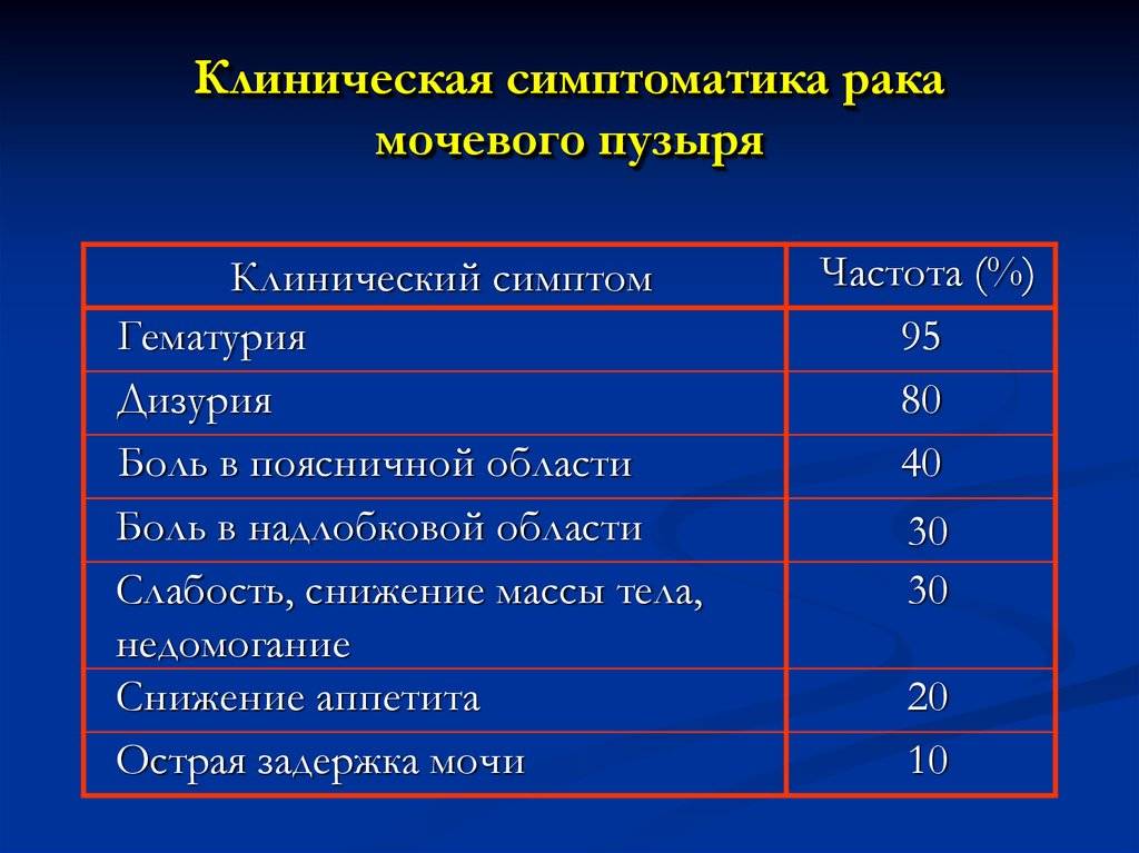 Рак мочевого пузыря - стадии, симптомы, диагностика