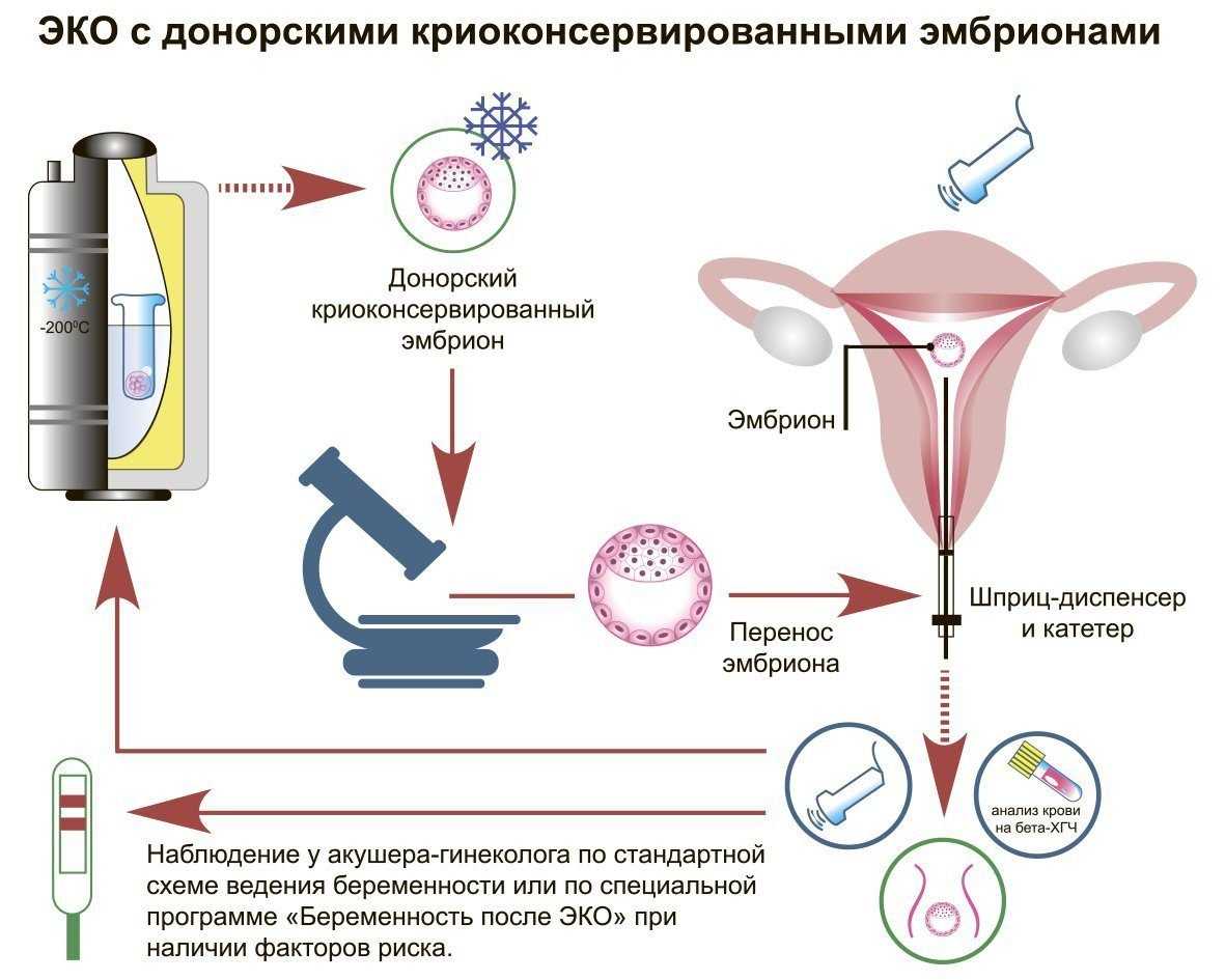 Особенности и преимущества процедуры эко в польше