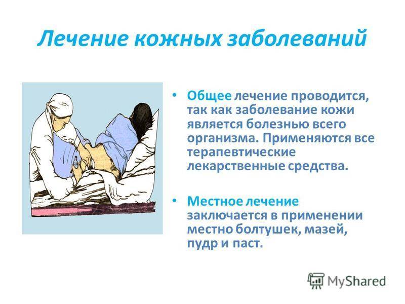 Лечение псориаза в хадассе