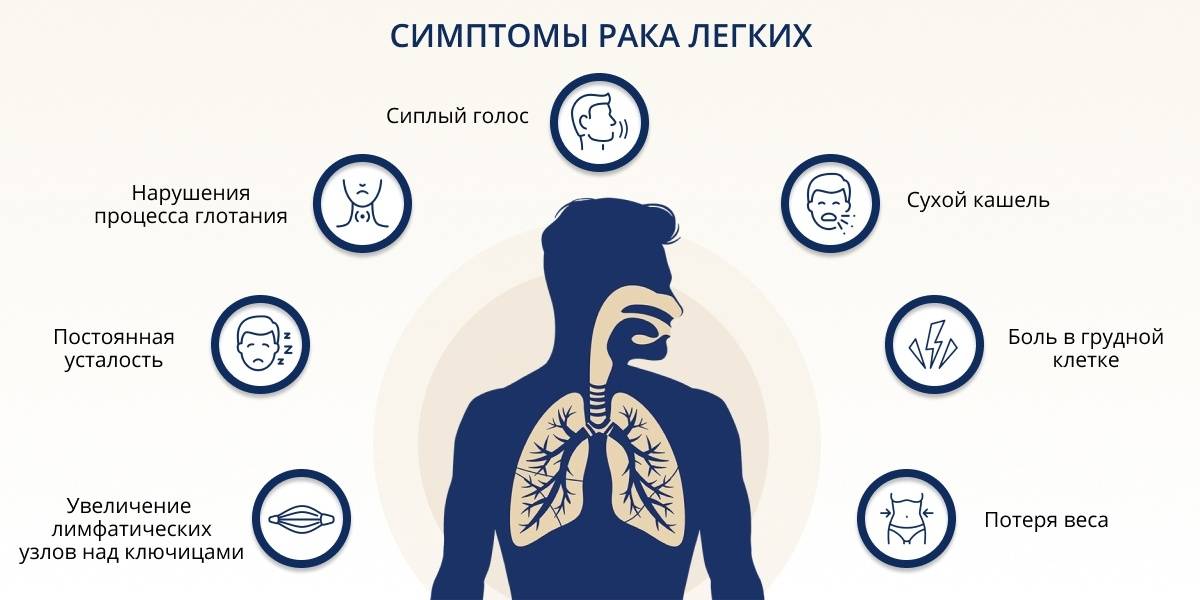 Лечение рака легких 4 стадии в германии
